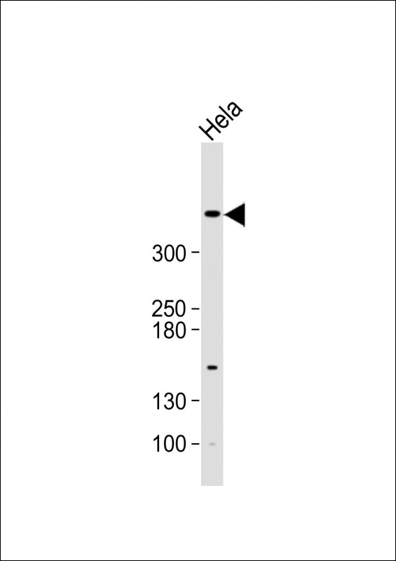 WB - ATM Antibody (N-term) AP8046a